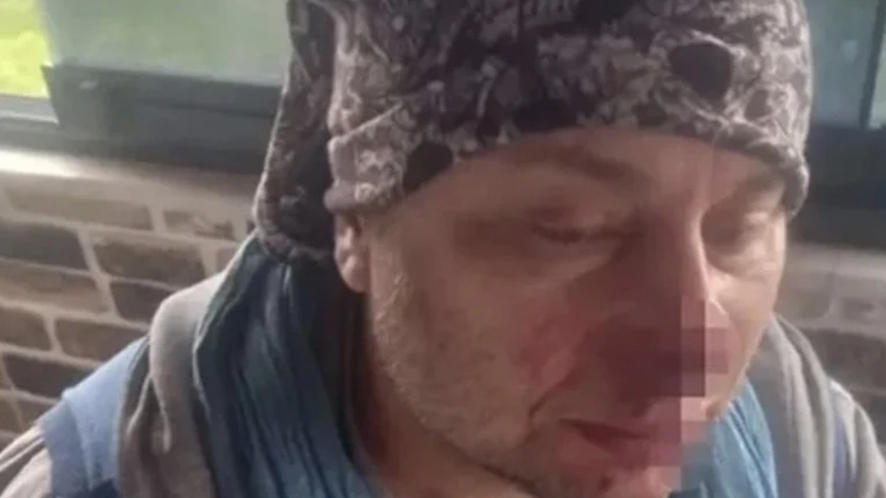 Ünlü sanatçı pitbull saldırısında hastanelik oldu