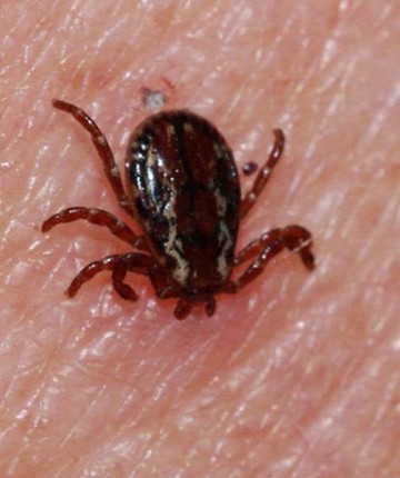 Kene ısırığı can aldı