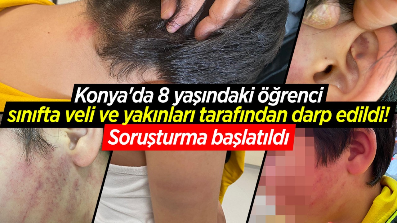 Konya'da 8 yaşındaki öğrenci sınıfta veli ve yakınları tarafından darp edildi! Soruşturma başlatıldı