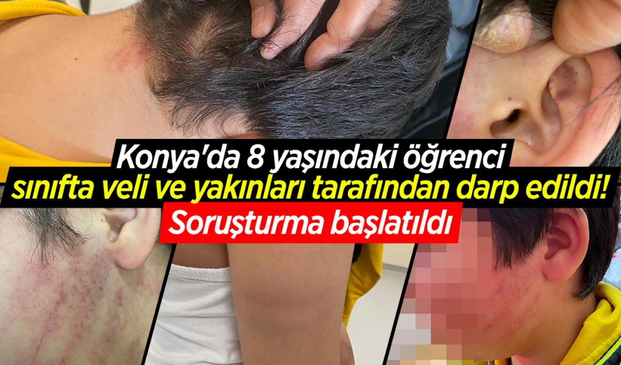 Konya'da 8 yaşındaki öğrenci sınıfta veli ve yakınları tarafından darp edildi! Soruşturma başlatıldı