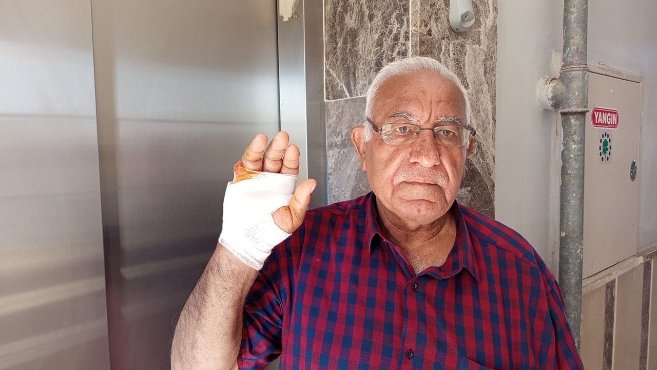 Komşusunun ısırdığı parmağı ampute edildi