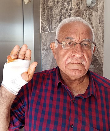 Komşusunun ısırdığı parmağı ampute edildi