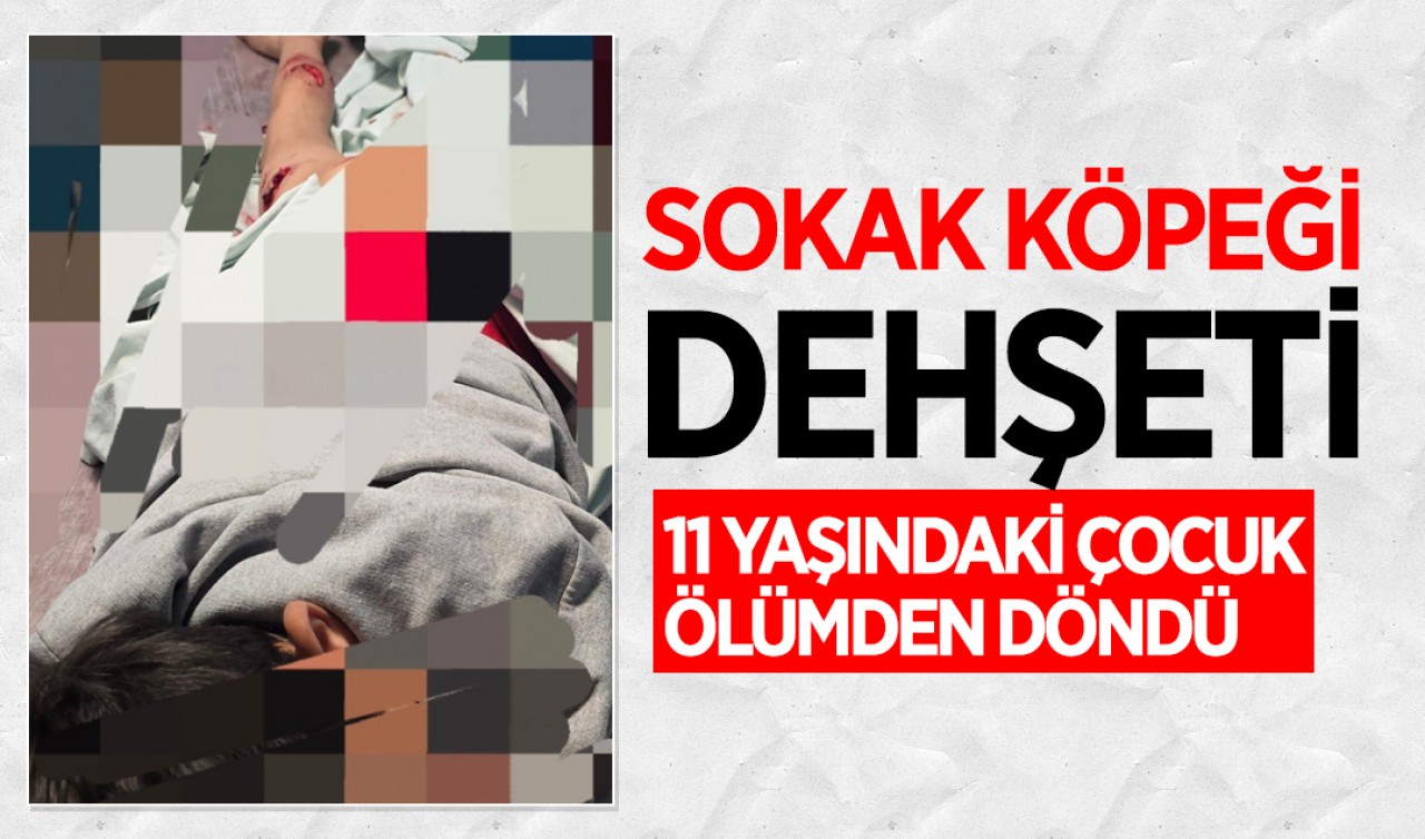 Sokak köpeği dehşeti: 11 yaşındaki çocuk ölümden döndü