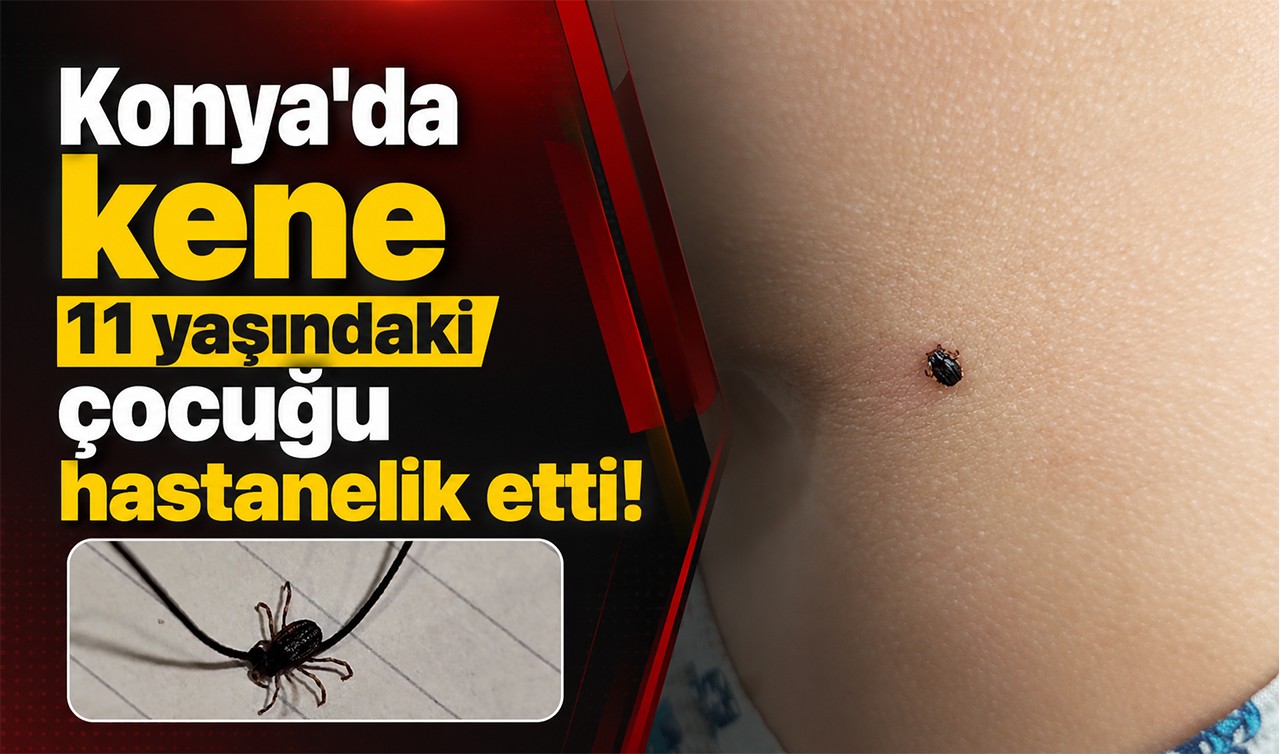 Konya'da kene 11 yaşındaki çocuğu hastanelik etti!