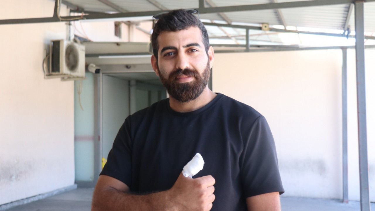 Acemi kasaplar acilleri doldurdu: "Amca beni yaktın"