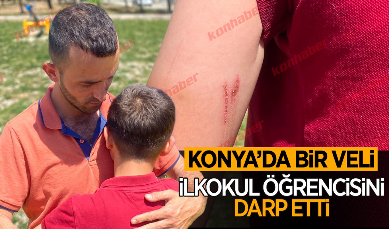 Konya'da bir veli ilkokul öğrencisini darp etti