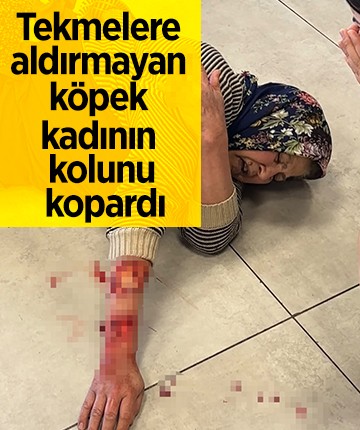 Tekmelere aldırmayan köpek kadının kolunu kopardı