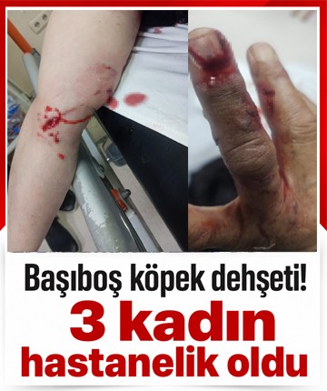 Başıboş köpek dehşeti! 3 kadın hastanelik oldu