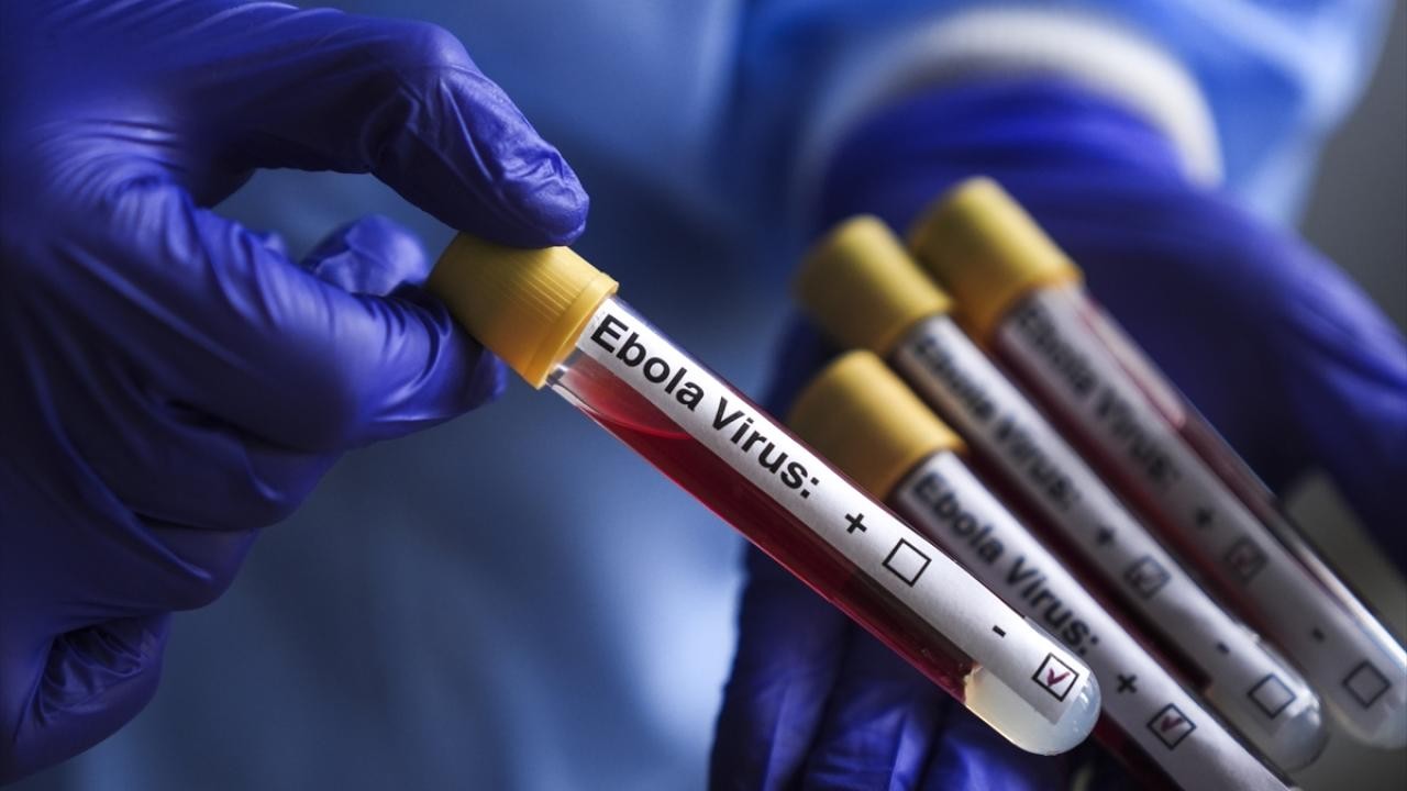 Ebola vakasıyla temas ettiği düşünülen 5 kişi karantinaya alındı