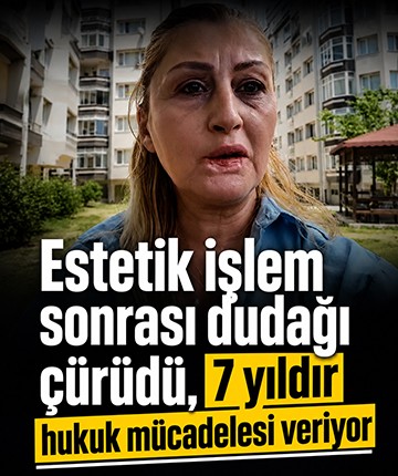 Estetik işlem sonrası dudağı çürüdü, 7 yıldır hukuk mücadelesi veriyor