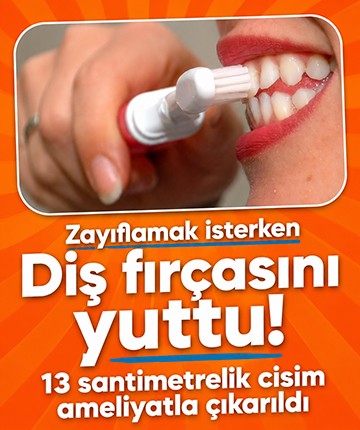 Zayıflamak isterken diş fırçasını yuttu: 13 santimetrelik cisim ameliyatla çıkarıldı