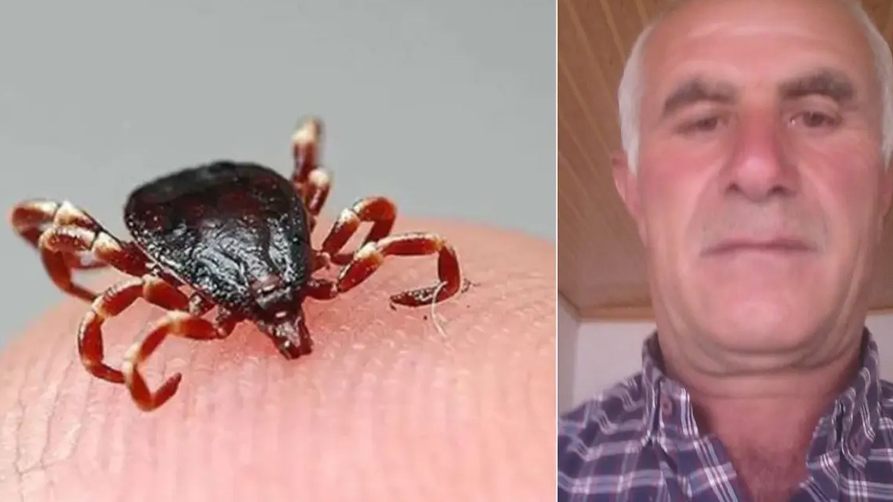 Vücuduna yapışan keneyi kendi çıkardı! 4 gün sonra öldü