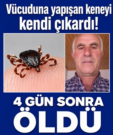 Vücuduna yapışan keneyi kendi çıkardı! 4 gün sonra öldü