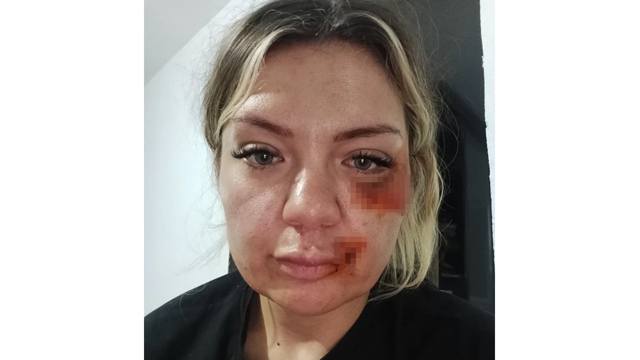 Eski sevgili dehşeti yaşattı! Kırılan bıçakla vurmaya devam etti