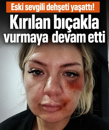 Eski sevgili dehşeti yaşattı! Kırılan bıçakla vurmaya devam etti