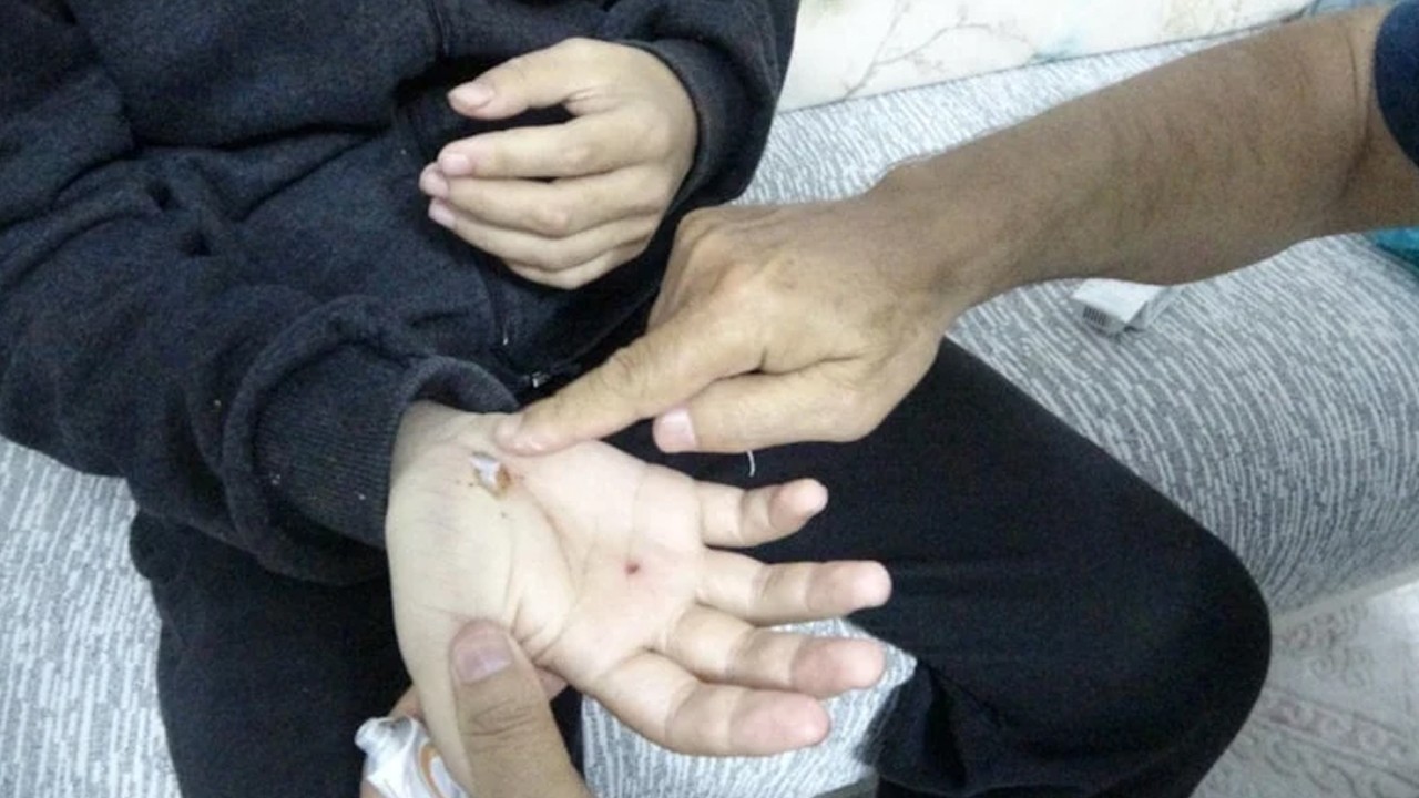 Otizmli oğluyla doğa gezisi sırasında sahipli köpeklerin saldırısına uğradı
