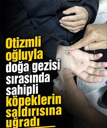 Otizmli oğluyla doğa gezisi sırasında sahipli köpeklerin saldırısına uğradı