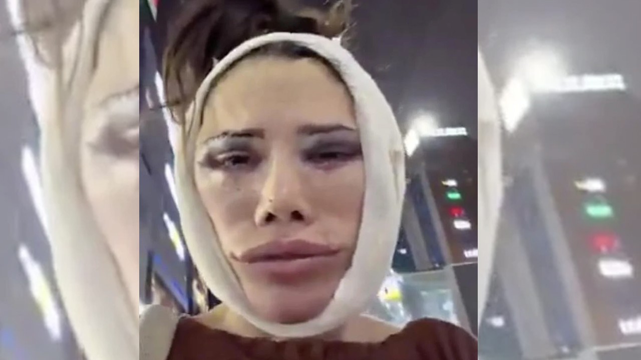 Yüz nakil ameliyatı olmuştu! Didem Ceran hastane tarafından sokağa atıldı
