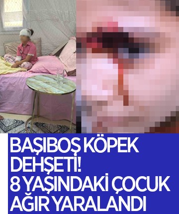 Başıboş köpek dehşeti! 8 yaşındaki çocuk ağır yaralandı
