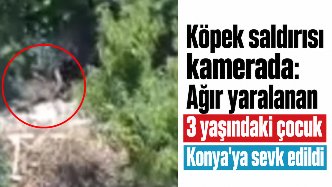 Köpek saldırısı kamerada: Ağır yaralanan 3 yaşındaki çocuk Konya'ya sevk edildi