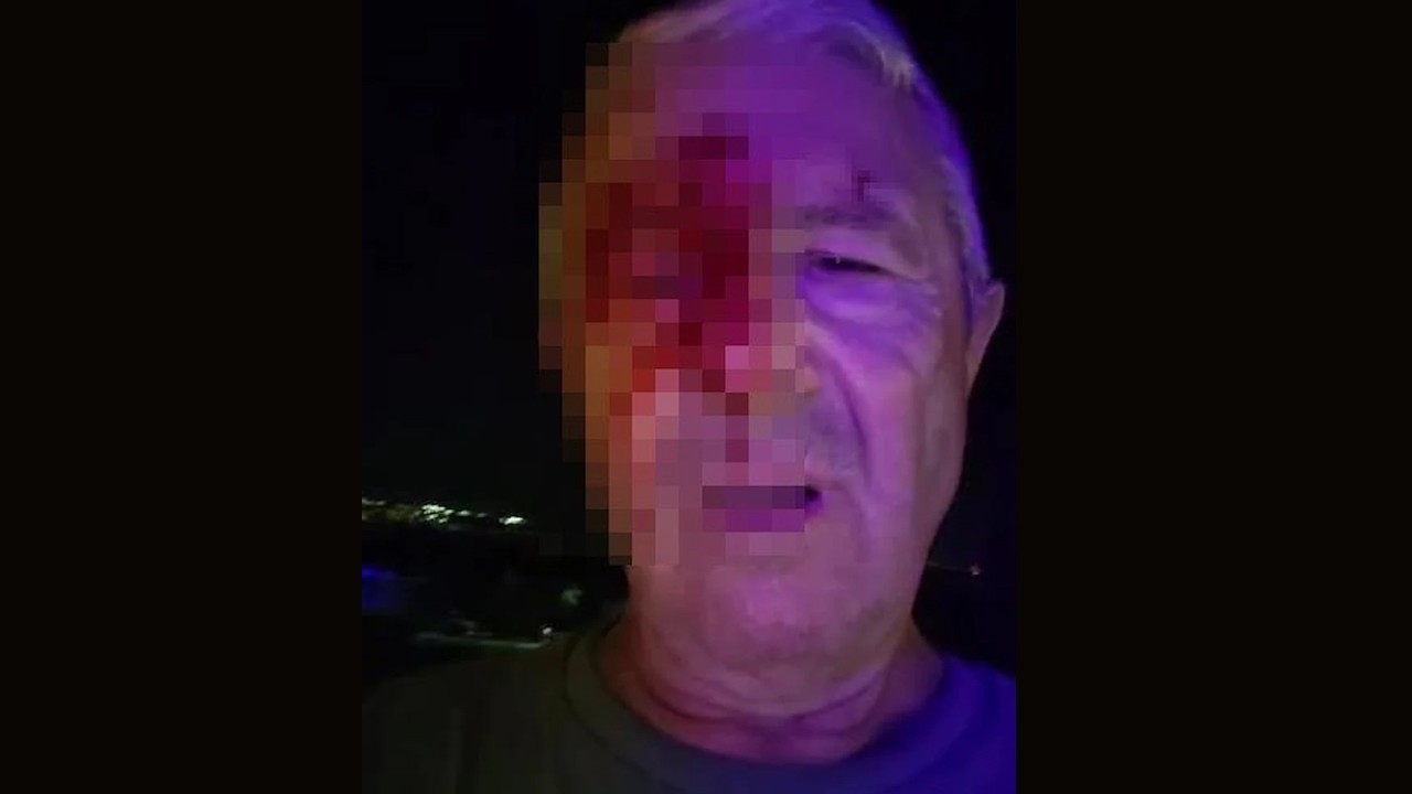 Haber yapmak için giden muhabir saldırıya uğradı