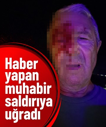 Haber yapmak için giden muhabir saldırıya uğradı