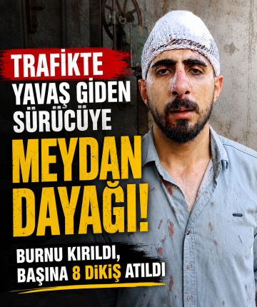 Trafikte yavaş giden sürücüye meydan dayağı: Burnu kırıldı, başına 8 dikiş atıldı